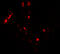 Cytidine/Uridine Monophosphate Kinase 2 antibody, 7063, ProSci, Immunofluorescence image 