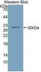 Inv antibody, LS-C374532, Lifespan Biosciences, Western Blot image 