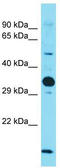 NUS1 Dehydrodolichyl Diphosphate Synthase Subunit antibody, TA333649, Origene, Western Blot image 