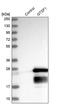 GTSF1 antibody, PA5-58575, Invitrogen Antibodies, Western Blot image 