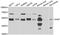 X-Linked Inhibitor Of Apoptosis antibody, abx005234, Abbexa, Western Blot image 