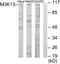 Mitogen-Activated Protein Kinase Kinase Kinase 13 antibody, TA314872, Origene, Western Blot image 