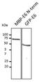 HPV11 E6 antibody, LS-C204266, Lifespan Biosciences, Western Blot image 