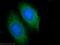 Zinc Finger FYVE-Type Containing 28 antibody, 25360-1-AP, Proteintech Group, Immunofluorescence image 