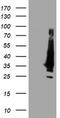 Potassium Voltage-Gated Channel Subfamily J Member 3 antibody, TA504137, Origene, Western Blot image 