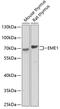 Essential Meiotic Structure-Specific Endonuclease 1 antibody, GTX33179, GeneTex, Western Blot image 