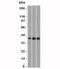 Cyclin D1 antibody, 34-159, ProSci, Western Blot image 