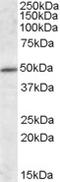Intraflagellar Transport 57 antibody, TA305681, Origene, Western Blot image 