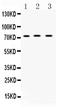 ATP Binding Cassette Subfamily G Member 8 antibody, LS-C662100, Lifespan Biosciences, Western Blot image 