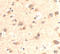RUN And SH3 Domain Containing 2 antibody, A12113-1, Boster Biological Technology, Immunohistochemistry frozen image 