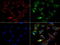 Keratin 8 antibody, LS-C796666, Lifespan Biosciences, Immunofluorescence image 