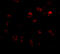 Kelch-like protein 15 antibody, A13892, Boster Biological Technology, Immunofluorescence image 
