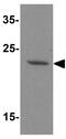 DRP1 antibody, GTX31918, GeneTex, Western Blot image 