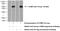 Cartilage oligomeric matrix protein antibody, 13641-1-AP, Proteintech Group, Western Blot image 