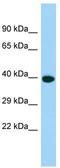 G Protein-Coupled Receptor 25 antibody, TA332063, Origene, Western Blot image 