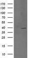 Mitogen-Activated Protein Kinase Kinase 3 antibody, TA505876BM, Origene, Western Blot image 