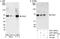 Gamma-PAK antibody, A301-264A, Bethyl Labs, Western Blot image 
