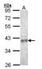 Coproporphyrinogen-III oxidase, mitochondrial antibody, orb69786, Biorbyt, Western Blot image 