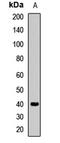 Alcohol Dehydrogenase 1B (Class I), Beta Polypeptide antibody, LS-C667689, Lifespan Biosciences, Western Blot image 