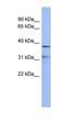 Hes Related Family BHLH Transcription Factor With YRPW Motif 2 antibody, orb330031, Biorbyt, Western Blot image 