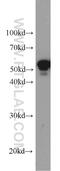 Keratin 7 antibody, 15539-1-AP, Proteintech Group, Western Blot image 