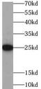 C-Reactive Protein antibody, FNab01994, FineTest, Western Blot image 