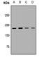 MLL antibody, LS-C667716, Lifespan Biosciences, Western Blot image 