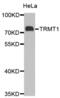 TRNA Methyltransferase 1 antibody, abx004599, Abbexa, Western Blot image 