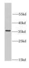 CCR4-NOT transcription complex subunit 8 antibody, FNab01812, FineTest, Western Blot image 