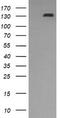 Platelet Derived Growth Factor Receptor Beta antibody, TA506227S, Origene, Western Blot image 