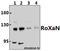 Zinc Finger CCCH-Type Containing 7B antibody, A10596-1, Boster Biological Technology, Western Blot image 