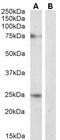 Arrestin 3 antibody, 42-024, ProSci, Enzyme Linked Immunosorbent Assay image 