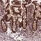 Ribonucleoprotein, PTB Binding 1 antibody, NBP2-47313, Novus Biologicals, Immunohistochemistry frozen image 
