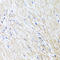 L-2-Hydroxyglutarate Dehydrogenase antibody, A06150, Boster Biological Technology, Immunohistochemistry paraffin image 