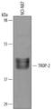 Tumor Associated Calcium Signal Transducer 2 antibody, AF650, R&D Systems, Western Blot image 