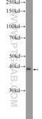 Peroxisomal Biogenesis Factor 2 antibody, 22163-1-AP, Proteintech Group, Western Blot image 