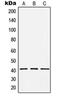 Holocytochrome C Synthase antibody, orb214033, Biorbyt, Western Blot image 