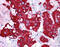 Nuclear Receptor Subfamily 4 Group A Member 2 antibody, ARP38753_P050, Aviva Systems Biology, Immunohistochemistry paraffin image 
