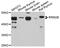 Ribonucleotide Reductase Regulatory TP53 Inducible Subunit M2B antibody, abx127039, Abbexa, Western Blot image 