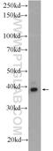Polycomb Group Ring Finger 6 antibody, 24103-1-AP, Proteintech Group, Western Blot image 