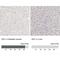 SIX Homeobox 1 antibody, NBP1-84264, Novus Biologicals, Immunohistochemistry paraffin image 