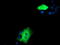 ZFP36 Ring Finger Protein antibody, LS-C785603, Lifespan Biosciences, Immunofluorescence image 