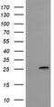Mitochondrial Ribosomal Protein S34 antibody, M14945-1, Boster Biological Technology, Western Blot image 