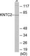 NDC80 Kinetochore Complex Component antibody, EKC1623, Boster Biological Technology, Western Blot image 