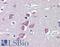 Transient Receptor Potential Cation Channel Subfamily M Member 2 antibody, LS-B4122, Lifespan Biosciences, Immunohistochemistry frozen image 