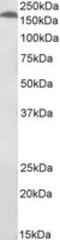 BLM RecQ Like Helicase antibody, MBS423051, MyBioSource, Western Blot image 