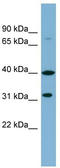 Ferric Chelate Reductase 1 Like antibody, TA341929, Origene, Western Blot image 