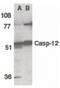Caspase-12 antibody, PA5-19962, Invitrogen Antibodies, Western Blot image 