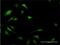 Eukaryotic Translation Initiation Factor 5A antibody, H00001984-M01, Novus Biologicals, Immunofluorescence image 