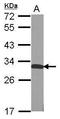 Quinoid Dihydropteridine Reductase antibody, GTX104428, GeneTex, Western Blot image 